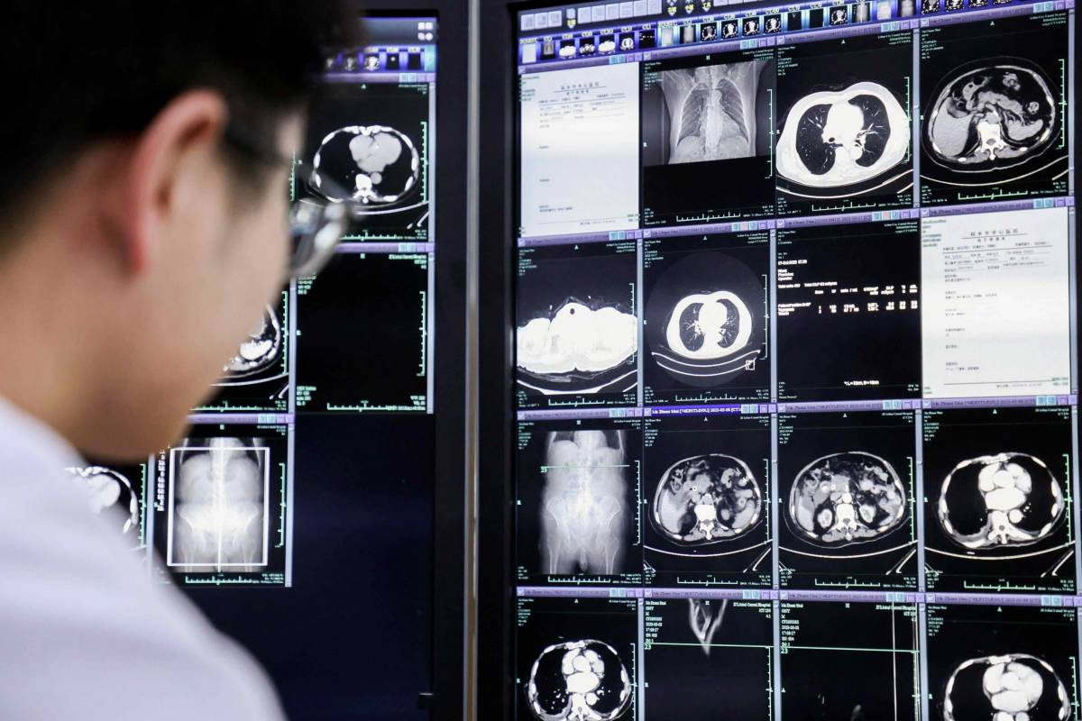 Doctor at a hospital in Lishui city of China's Zhejiang province examines a CT scan. Photo credit: Alibaba Group